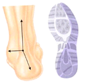 laufanalyse-supination